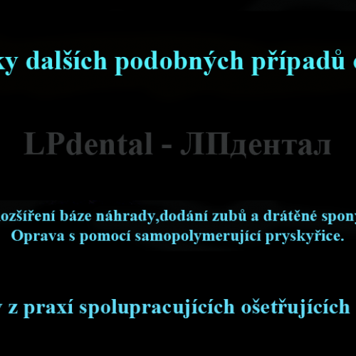 9 Oprava samopolymerující pryskyřicí-rozšíření báze-dodání zubů a drátěné spony....png
