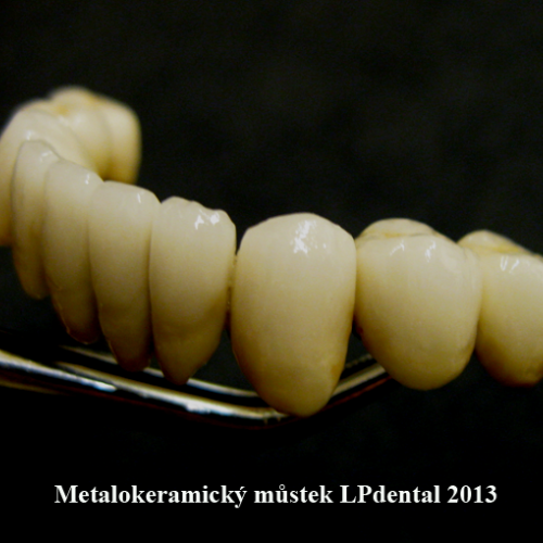 23  MUDr.Jana Lajčíková-Petr Moj-LPdental-keramika.png