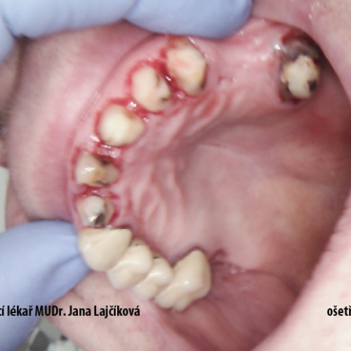 6  MUDr.Jana Lajčíková-Petr Moj- LPdental-keramika NORITAKE ノリタケ.png
