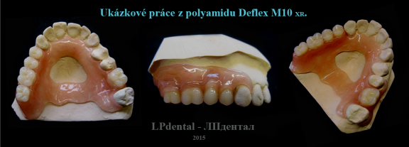 3 Ukázkové práce z polyamidu Deflex M10 (Nuxen S.r.l.) pro firmu Complete Dental.png