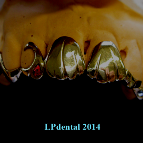 19 Grillz-individuální výrobek.png