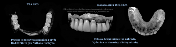 9  Staré zubní náhrady.png