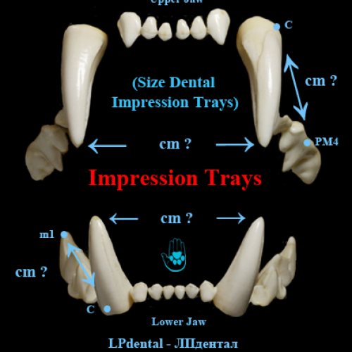 01 Impression Trays (Size Dental Impression Trays   )-LPdental -ЛПдентал.png