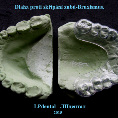 7 Dlaha proti skřípání zubů-Bruxismus.png