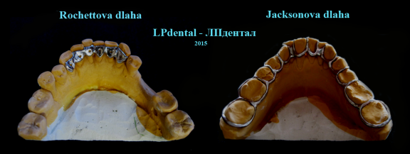 Rochettova-Jacksonova dlaha.png