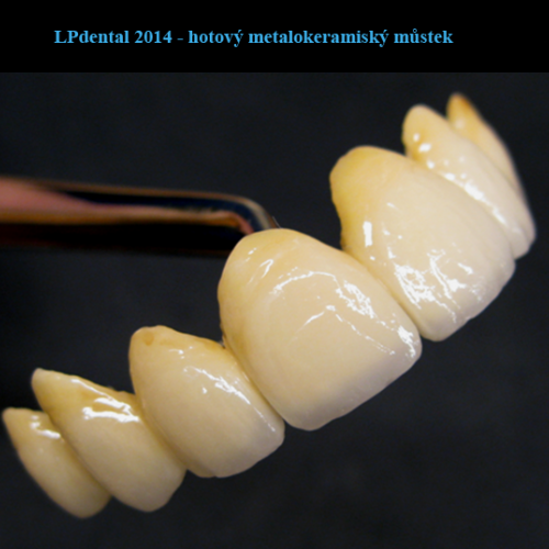 38  MUDr.Jana Lajčíková-Petr Moj-LPdental-keramika.png