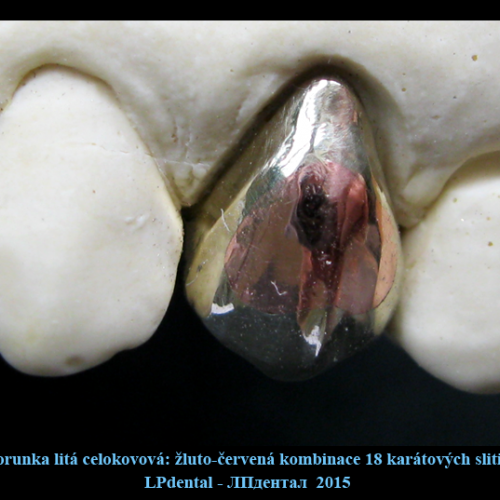 14 Korunka litá celokovová-žluto-červená kombinace 18 karátových zlatých slitin..png