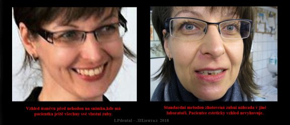 1-1 foto před nehodou-foto esteticky nevyhovující náhrada.jpg