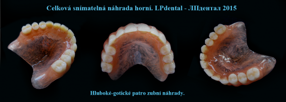 Hluboké-gotické patro zubní náhrady..png