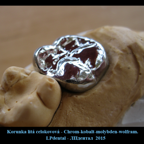 4 Korunka litá celokovová - chromkobaltová slitina.png