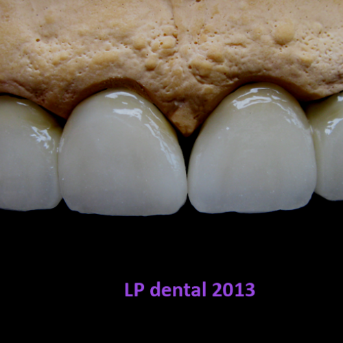 30 MUDr.Jana Lajčíková-Petr Moj-LPdental-keramika.png