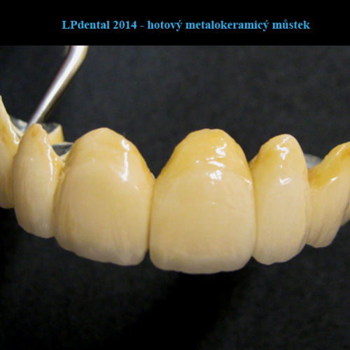 37  MUDr.Jana Lajčíková-Petr Moj-LPdental-keramika.png
