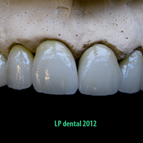 20  MUDr.Jana Lajčíková-Petr Moj- LPdental-keramika NORITAKE ノリタケ.png