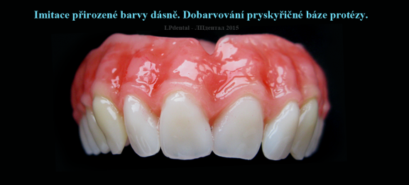 Imitace přirozené barvy dásně.Dobarvování pryskyřičné báze protézy..png