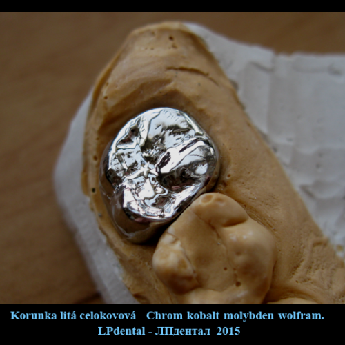 3 Korunka litá celokovová- chromkobaltová slitina.png