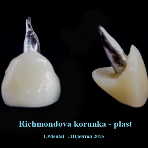 2 Richmondova korunka- plast.png
