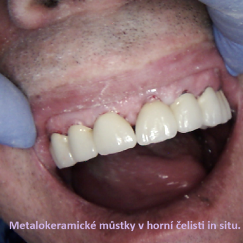 31 MUDr.Jana Lajčíková-Petr Moj-LPdental-keramika.png