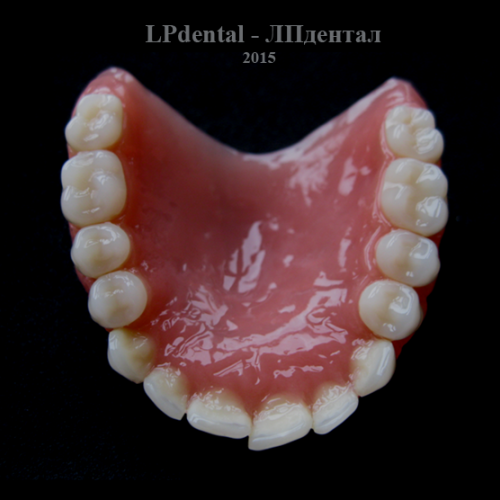 17 Ukázkové práce z pryskyřice Acry Pol-R (Ruthinium Group) pro firmu Complete Dental.png