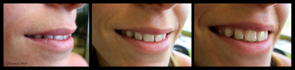 1-1 Teeth Jewelry.png