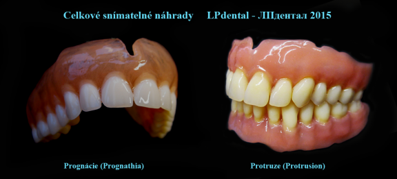 Prognathie-Protrusion-LPdental -ЛПдентал.png