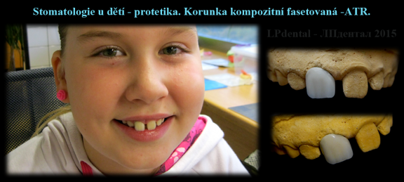 Stomatologie u dětí-korunka kompozitní fasetovaná-ATR..png