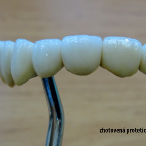 9  MUDr.Jana Lajčíková-Petr Moj- LPdental-keramika NORITAKE ノリタケ.png