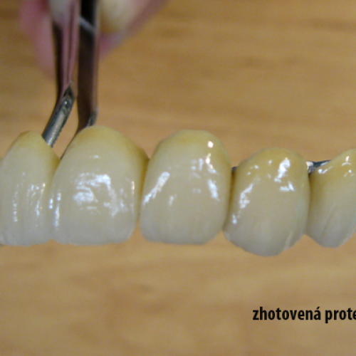 15  MUDr.Jana Lajčíková-Petr Moj- LPdental-keramika NORITAKE ノリタケ.png