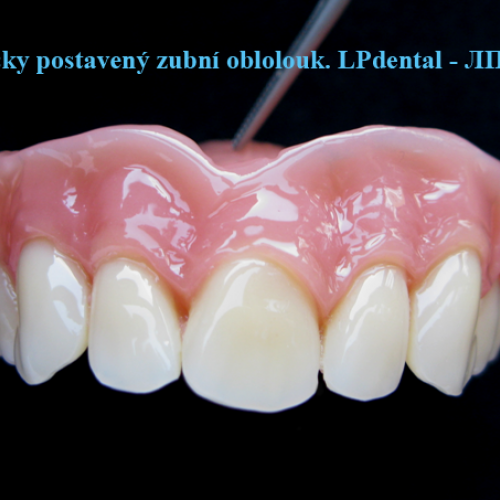 3 Atypicky postavený zubní oblouk.png