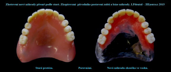 3 Porovnání-stará zubní náhrada s novou zubní náhradou ve zkoušce..png