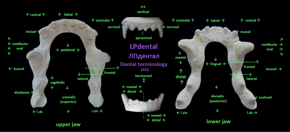 LPdental (ЛПдентал) Dental terminology.png