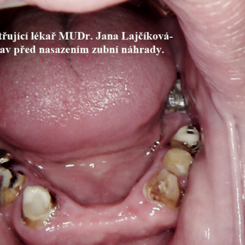 22 MUDr.Jana Lajčíková-Petr Moj-LPdental-keramika.png
