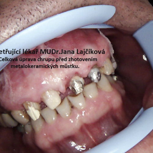 28 MUDr.Jana Lajčíková-Petr Moj-LPdental-keramika.png