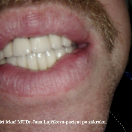 26  MUDr.Jana Lajčíková-Petr Moj-LPdental-keramika.png
