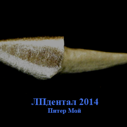 31 inlay kořenová-celolitá.png
