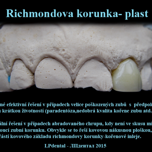 1 Richmondova korunka- plast.png