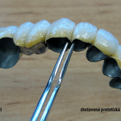 7  MUDr.Jana Lajčíková-Petr Moj- LPdental-keramika NORITAKE ノリタケ.png