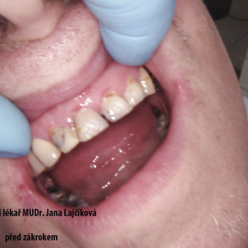 5  MUDr.Jana Lajčíková-Petr Moj- LPdental-keramika NORITAKE ノリタケ.png