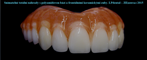 4 Polyamidová báze s keramickými zuby -Deflex Classic.png