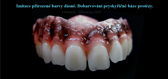 Dobarvování pryskyřičné báze protézy-physiologic-racial-pigmentation.png