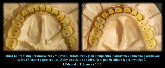 1 Polyamidová báze s keramickými zuby -Deflex Classic.png