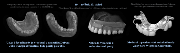13 Umělé zuby Sira Winstona Churchilla.png