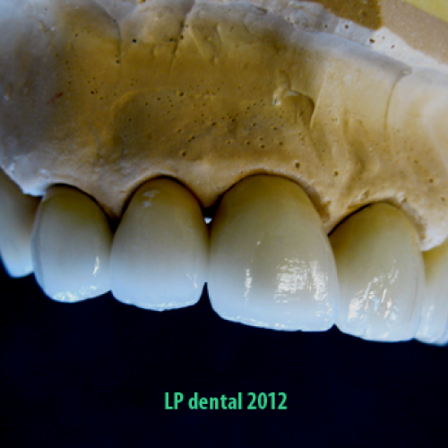 19  MUDr.Jana Lajčíková-Petr Moj- LPdental-keramika NORITAKE ノリタケ.png