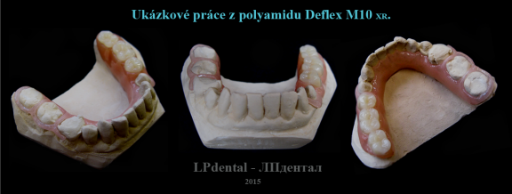 8 Ukázkové práce z polyamidu Deflex M10 (Nuxen S.r.l.) pro firmu Complete Dental.png