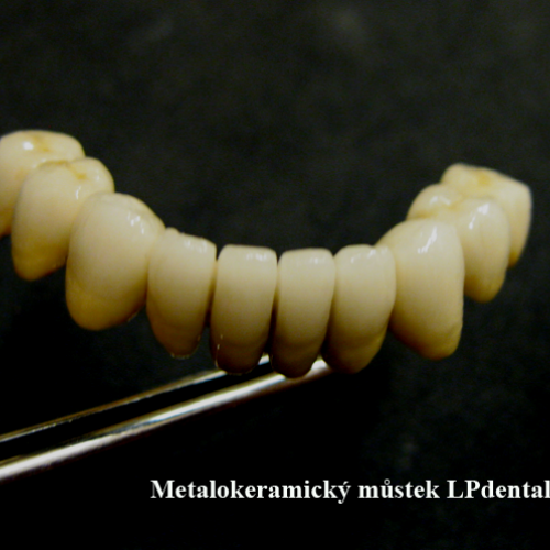 24  MUDr.Jana Lajčíková-Petr Moj-LPdental-keramika.png