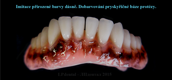 Dobarvování pryskyřičné báze protézy-physiologic-racial-pigmentation..png