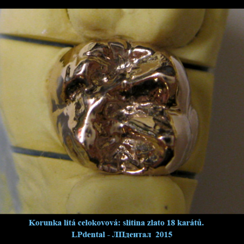 10 Korunka litá celokovová-zlatá 18 karátová slitina..png