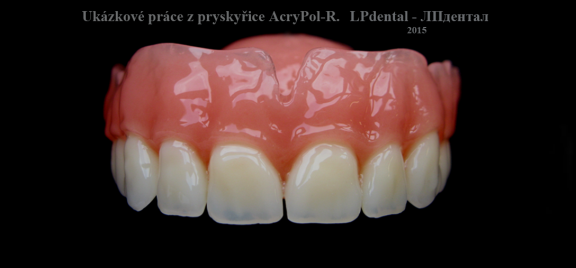20 Ukázkové práce z pryskyřice Acry Pol-R (Ruthinium Group) pro firmu Complete Dental.png
