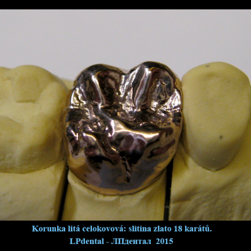 11 Korunka litá celokovová-zlatá 18 karátová slitina..png